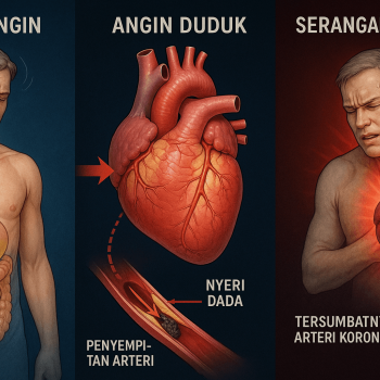 Perbedaan Masuk Angin, Angin Duduk, dan Serangan Jantung