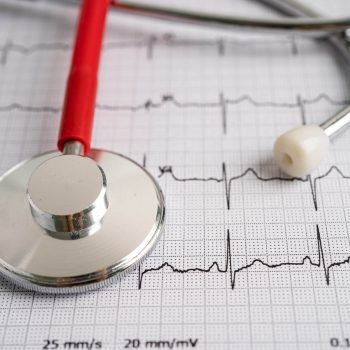 Detak Jantung Tidak Teratur? Kenali Aritmia Sebelum Terlambat!