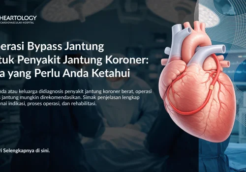 Operasi Bypass Jantung untuk Penyakit Jantung Koroner: Apa yang Perlu Anda Ketahui
