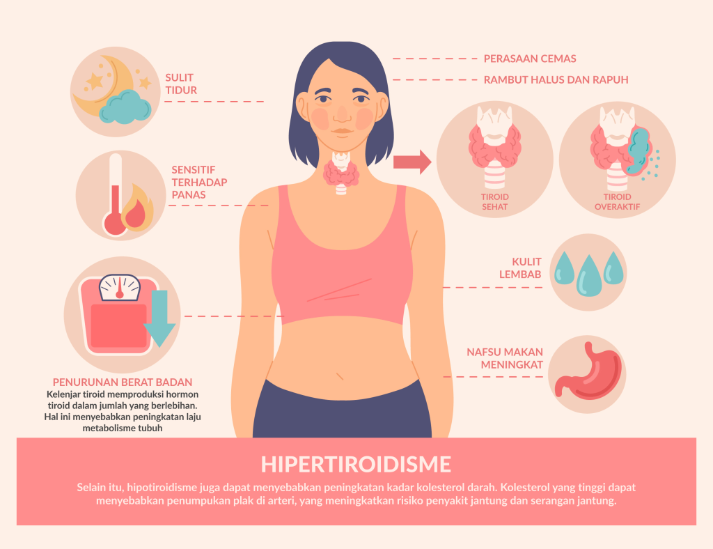 Infografis Penyakit Tiroid Hipertiroidisme