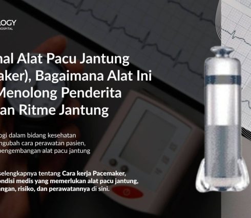 Mengenal Alat Pacu Jantung (Pacemaker), Bagaimana Alat Ini dapat Menolong Penderita Gangguan Ritme Jantung