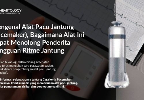 Mengenal Alat Pacu Jantung (Pacemaker), Bagaimana Alat Ini dapat Menolong Penderita Gangguan Ritme Jantung