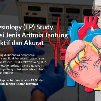 Electrophysiology (EP) Study, Mendeteksi Jenis Aritmia Jantung Secara Efektif dan Akurat