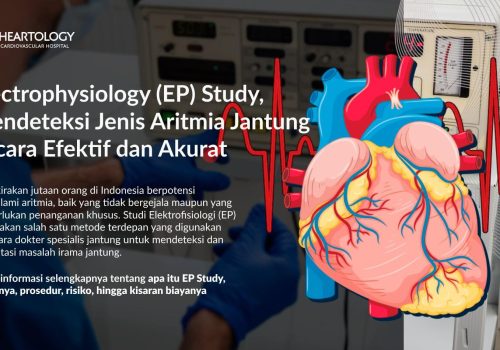 Electrophysiology (EP) Study, Mendeteksi Jenis Aritmia Jantung Secara Efektif dan Akurat