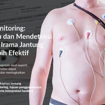 Holter Monitoring: Memantau dan Mendeteksi Gangguan Irama Jantung Secara Lebih Efektif