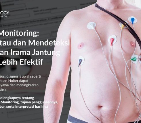 Holter Monitoring: Memantau dan Mendeteksi Gangguan Irama Jantung Secara Lebih Efektif