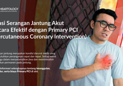 Atasi Serangan Jantung Akut Secara Efektif dengan Primary PCI (Percutaneous Coronary Intervention)