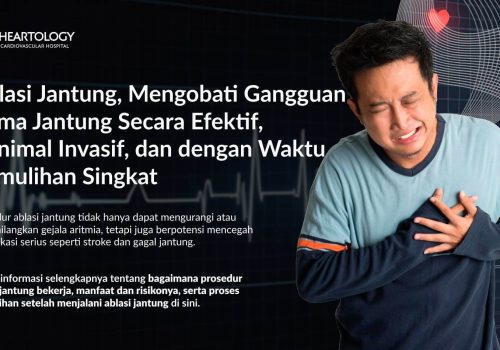 Ablasi Jantung: Prosedur, Manfaat, Risiko, dan Pemulihan