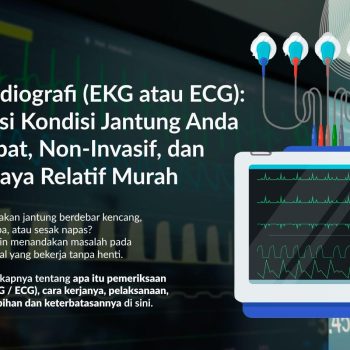 Elektrokardiografi (EKG atau ECG): Gambaran Umum, Manfaat, dan Hasil yang Diharapkan