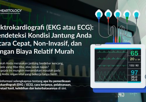 Elektrokardiografi (EKG atau ECG): Gambaran Umum, Manfaat, dan Hasil yang Diharapkan