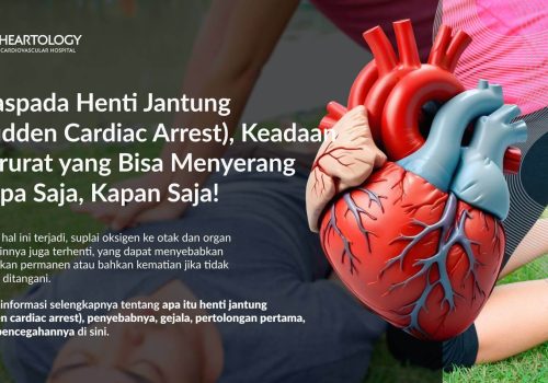 Henti Jantung (Sudden Cardiac Arrest): Penyebab, Gejala, dan Pencegahannya