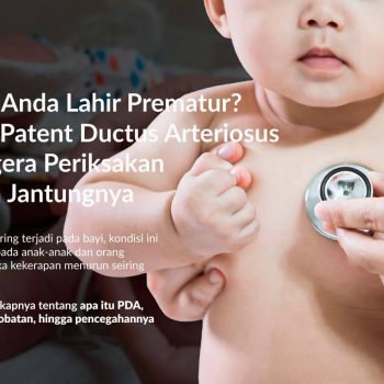 Patent Ductus Arteriosus (PDA): Kenali Gejala, Penanganan, dan Pencegahannya