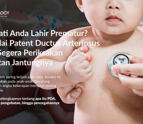 Patent Ductus Arteriosus (PDA): Kenali Gejala, Penanganan, dan Pencegahannya