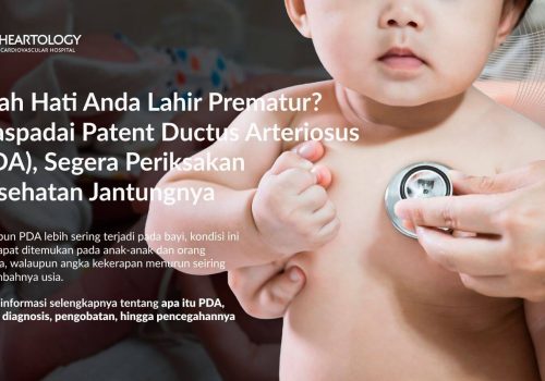 Patent Ductus Arteriosus (PDA): Kenali Gejala, Penanganan, dan Pencegahannya