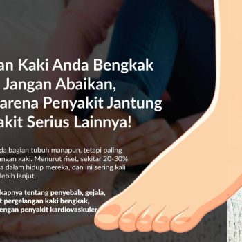 Pergelangan Kaki Bengkak (Edema): Gejala, Penyebab, Pengobatan, dan Pencegahannya
