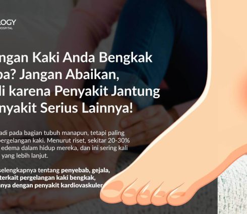 Pergelangan Kaki Bengkak (Edema): Gejala, Penyebab, Pengobatan, dan Pencegahannya