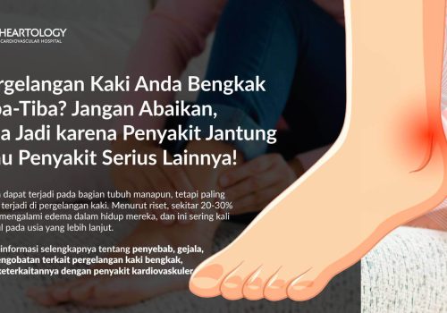 Pergelangan Kaki Bengkak (Edema): Gejala, Penyebab, Pengobatan, dan Pencegahannya
