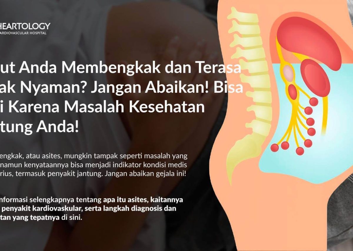Perut Bengkak (Asites): Penyebab, Gejala, Diagnosis, dan Pengobatannya