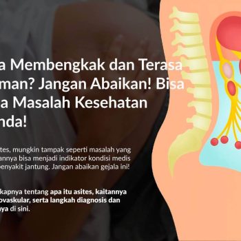 Perut Bengkak (Asites): Penyebab, Gejala, Diagnosis, dan Pengobatannya