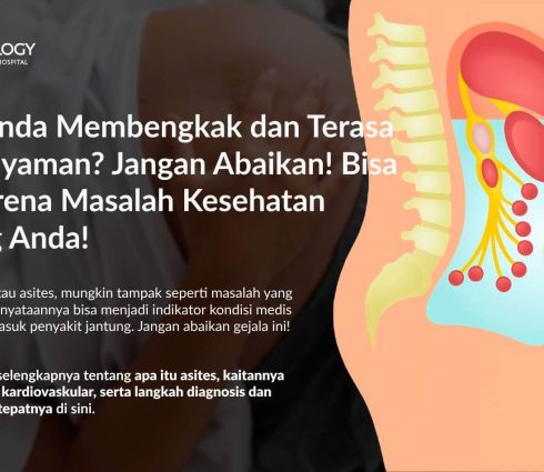 Perut Bengkak (Asites): Penyebab, Gejala, Diagnosis, dan Pengobatannya
