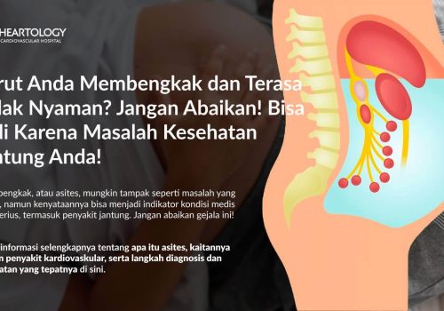 Perut Bengkak (Asites): Penyebab, Gejala, Diagnosis, dan Pengobatannya