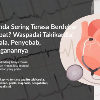 Takikardia: Gejala, Penyebab, Pengobatan, dan Pencegahannya