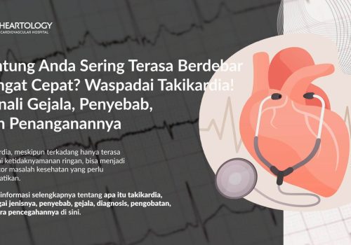 Takikardia: Gejala, Penyebab, Pengobatan, dan Pencegahannya