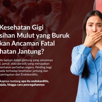 Endokarditis: Penyebab, Gejala dan Pengobatan
