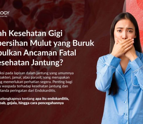 Endokarditis: Penyebab, Gejala dan Pengobatan