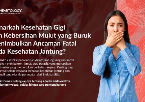 Endokarditis: Penyebab, Gejala dan Pengobatan