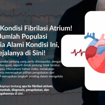 Fibrilasi Atrium: Gejala, Penyebab, Faktor Risiko, dan Pengobatannya