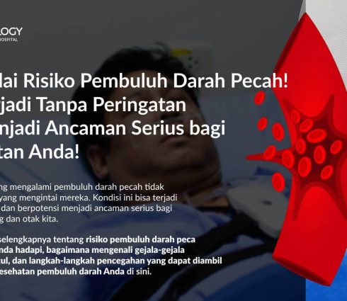 Pembuluh Darah Pecah: Penyebab, Gejala, dan Penangannya