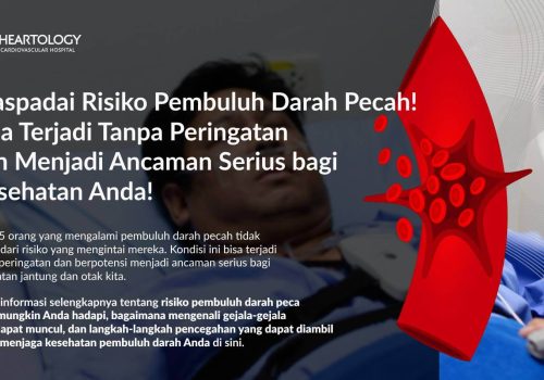 Pembuluh Darah Pecah: Penyebab, Gejala, dan Penangannya