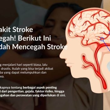 Waspada Stroke! Kenali Gejala Awal, Pemulihan, dan Pencegahannya