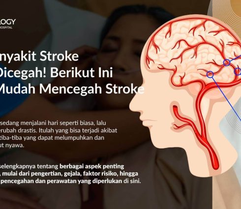 Waspada Stroke! Kenali Gejala Awal, Pemulihan, dan Pencegahannya