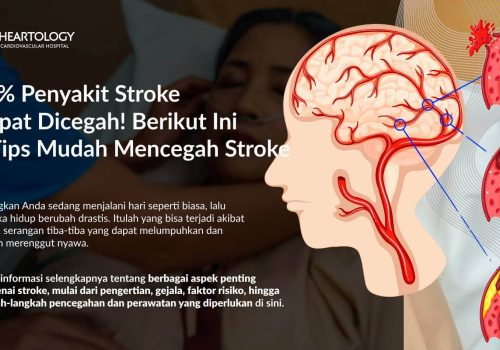 Waspada Stroke! Kenali Gejala Awal, Pemulihan, dan Pencegahannya
