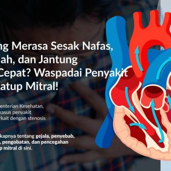 Stenosis Katup Mitral: Gejala, Penyebab, Faktor Risiko, dan Pengobatannya