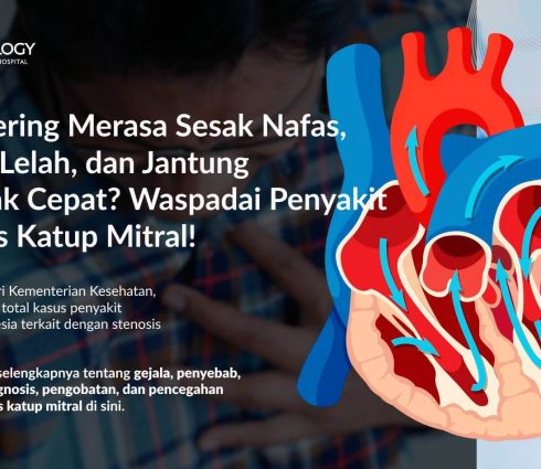 Stenosis Katup Mitral: Gejala, Penyebab, Faktor Risiko, dan Pengobatannya