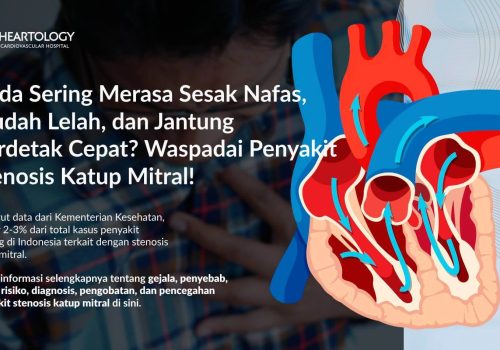 Stenosis Katup Mitral: Gejala, Penyebab, Faktor Risiko, dan Pengobatannya