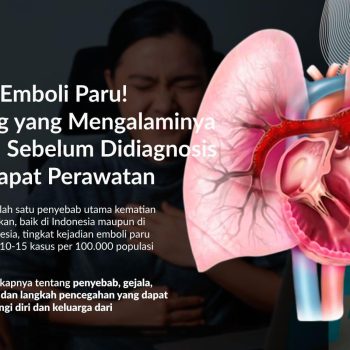 Emboli Paru (Pulmonary Embolism): Gejala, Penyebab, Pengobatan dan Pencegahannya