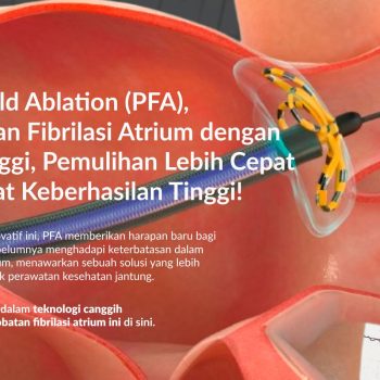 Pulsed Field Ablation (PFA): Inovasi Revolusioner dalam Pengobatan Fibrilasi Atrium