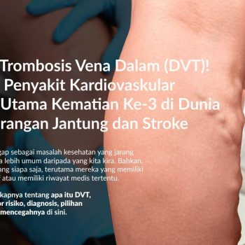 Trombosis Vena Dalam (DVT): Gejala, Penyebab, Pengobatan dan Pencegahannya
