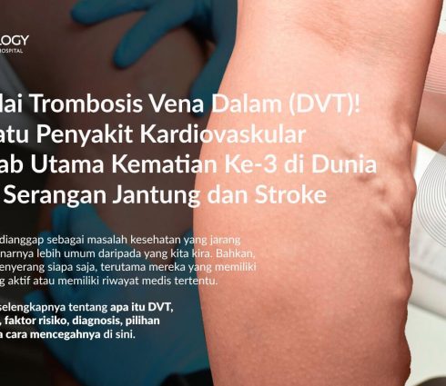 Trombosis Vena Dalam (DVT): Gejala, Penyebab, Pengobatan dan Pencegahannya
