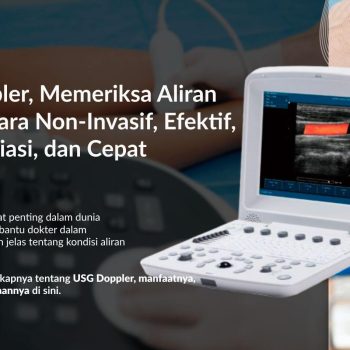 USG Doppler: Fungsi, Cara Kerja, dan Manfaatnya dalam Medis