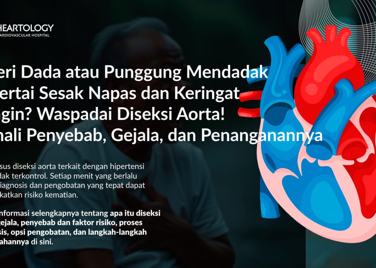 Diseksi Aorta: Gejala, Penyebab, Pengobatan dan Pencegahannya