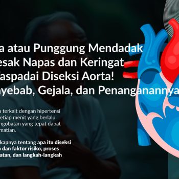 Diseksi Aorta: Gejala, Penyebab, Pengobatan dan Pencegahannya
