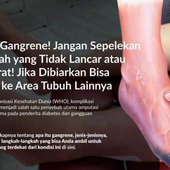 Gangrene: Gejala, Penyebab, Pengobatan dan Pencegahannya