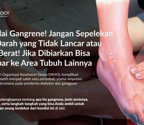 Gangrene: Gejala, Penyebab, Pengobatan dan Pencegahannya