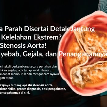 Stenosis Aorta: Gejala, Penyebab, Pengobatan dan Pencegahannya