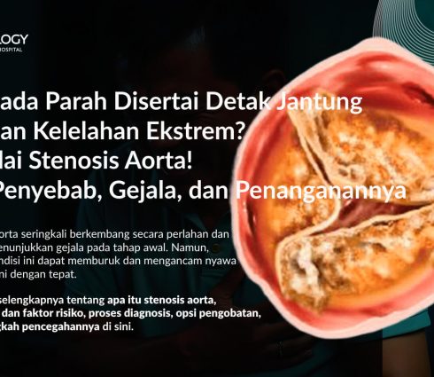Stenosis Aorta: Gejala, Penyebab, Pengobatan dan Pencegahannya